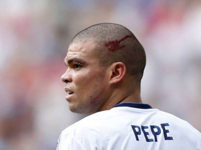 Pepe footballer